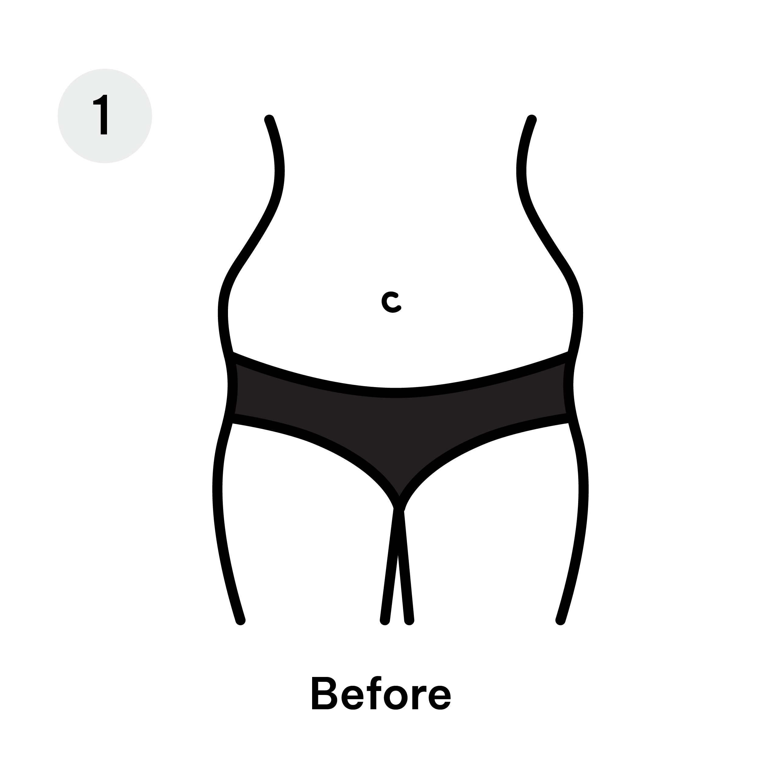 Liposuction before