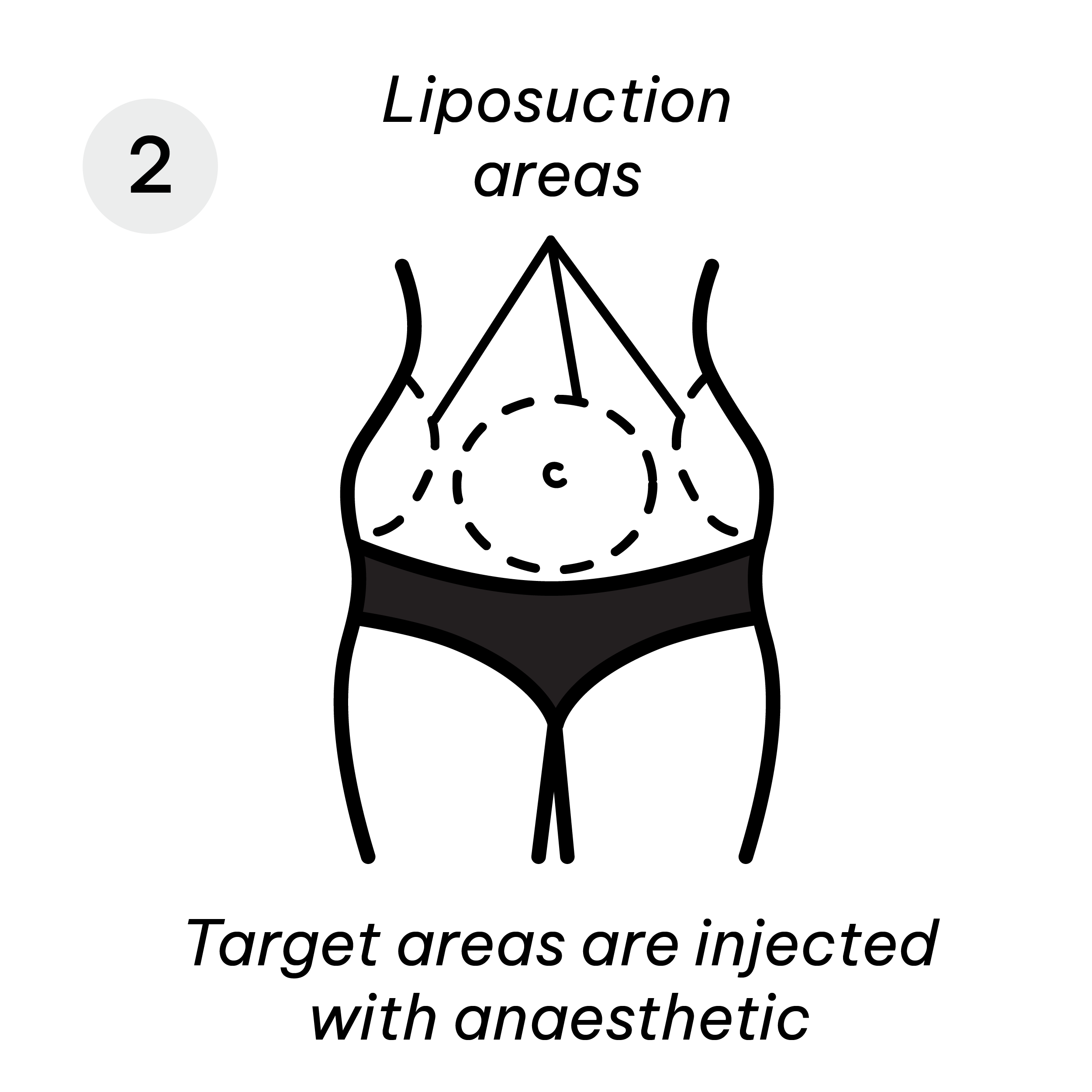 Liposuction Areas