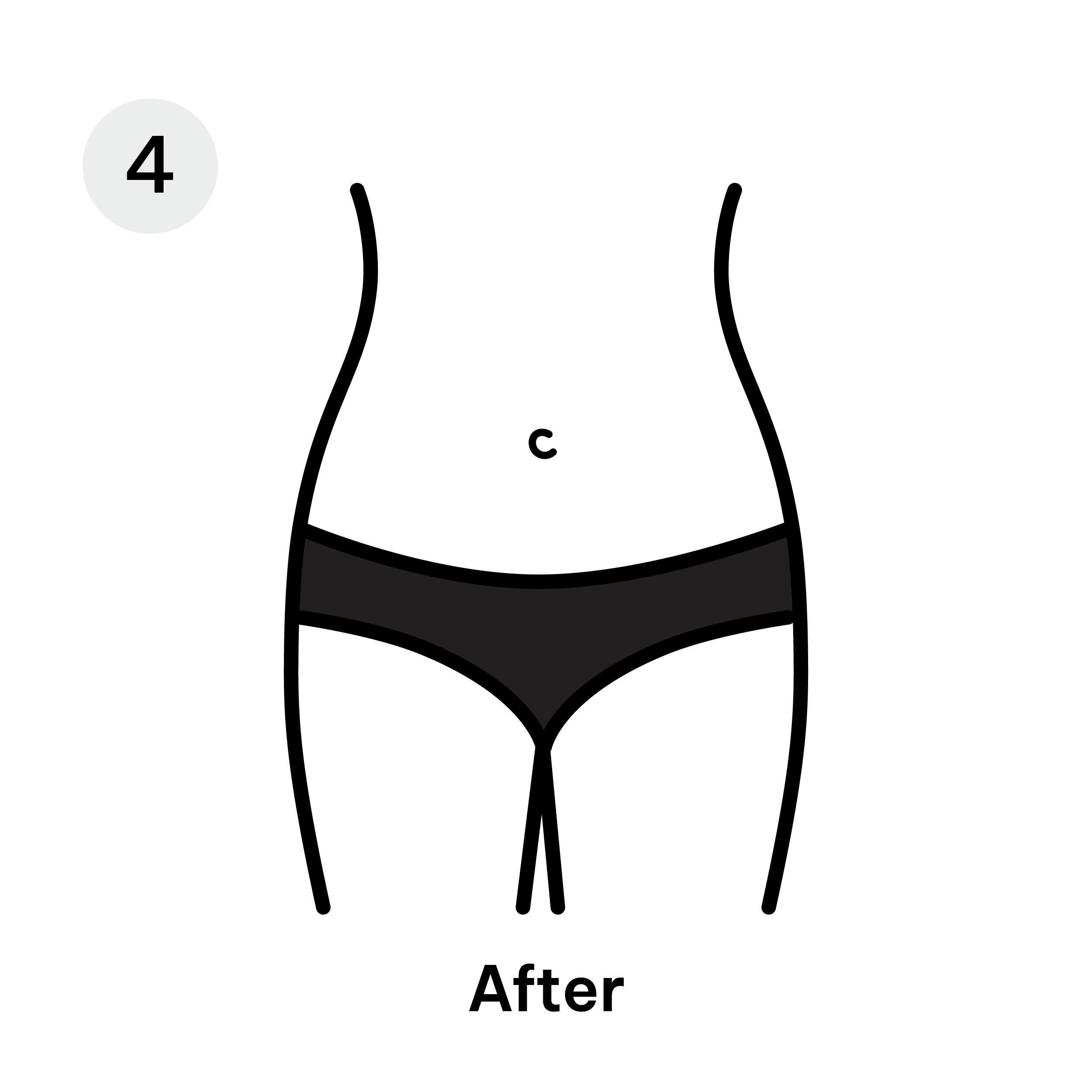 After Liposuction